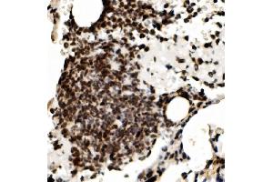 IHC analysis of RCC1 using anti-RCC1 antibody (ABIN7600024). (RCC1 抗体  (AA 14-421))