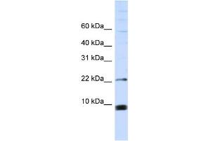 WB Suggested Anti-SNRPF Antibody Titration:  0.