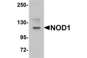 Western blot analysis of NOD1 in EL4 cell lysate with NOD1 antibody at 1 μg/ml. (NOD1 抗体  (C-Term))