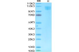 SDS-PAGE (SDS) image for Angiotensin I Converting Enzyme 2 (ACE2) (AA 18-739) protein (His-Avi Tag,Biotin) (ABIN7273790)