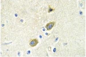 Image no. 2 for anti-Growth Arrest-Specific 6 (GAS6) antibody (ABIN317613) (GAS6 抗体)