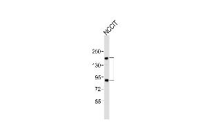 Anti-Sall4 Antibody (C-term)at 1:1000 dilution + NCCIT whole cell lysates Lysates/proteins at 20 μg per lane. (SALL4 抗体  (C-Term))