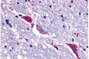 Anti-TACR3 antibody  ABIN1049392 IHC staining of human brain, hippocampus. (TACR3 抗体  (C-Term))