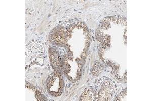 Immunohistochemical staining of human prostate with YIPF7 polyclonal antibody  shows moderate cytoplasmic positivity with a granular pattern in glandular cells. (YIPF7 抗体)