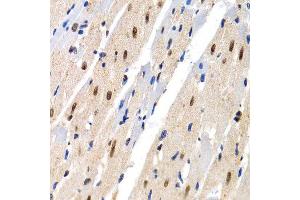 Immunohistochemistry of paraffin-embedded rat heart using MT2A antibody at dilution of 1:200 (400x lens).