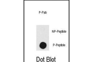 Dot blot analysis of anti-DNA-PK-p Pab (R) on nitrocellulose membrane. (PRKDC 抗体  (pThr2609))