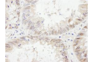 Immunohistochemistry (IHC) image for anti-Ets Variant 6 (ETV6) (AA 175-225) antibody (ABIN7454944)