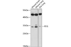 Western blot analysis of extracts of various cell lines, using PI15 antibody (ABIN7269205) at 1:1000 dilution. (PI15 抗体  (AA 61-170))