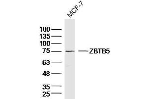 MCF-7 Cell lysates probed with ZBTB5 Polyclonal Antibody, unconjugated  at 1:300 overnight at 4°C followed by a conjugated secondary antibody for 60 minutes at 37°C. (ZBTB5 抗体  (AA 581-677))