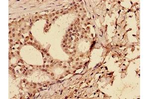 Immunohistochemistry (IHC) image for anti-Tumor Protein P53 (TP53) (AA 2-393) antibody (ABIN7147346)