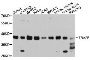 Western blot analysis of extracts of various cell lines, using TRA2B antibody.