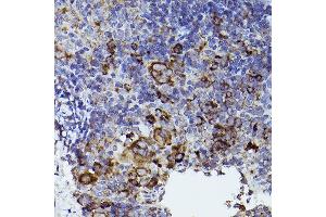 Immunohistochemistry of paraffin-embedded mouse spleen using THBS1 Rabbit pAb (ABIN3022978, ABIN3022979, ABIN3022980 and ABIN6219329) at dilution of 1:50 (40x lens). (Thrombospondin 1 抗体  (AA 80-360))