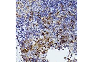 Immunohistochemistry of paraffin-embedded mouse spleen using THBS1 Rabbit pAb (ABIN3022978, ABIN3022979, ABIN3022980 and ABIN6219329) at dilution of 1:50 (40x lens). (Thrombospondin 1 抗体  (AA 80-360))