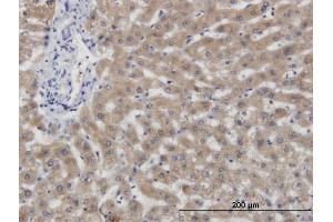 Immunoperoxidase of monoclonal antibody to CBS on formalin-fixed paraffin-embedded human liver. (CBS 抗体  (AA 1-100))