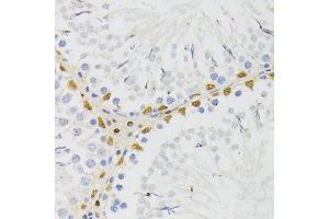 Immunohistochemistry of paraffin-embedded rat testis using EL antibody (ABIN6132052, ABIN6140108, ABIN6140109 and ABIN6222942) at dilution of 1:200 (40x lens). (ELAC2 抗体  (AA 1-270))