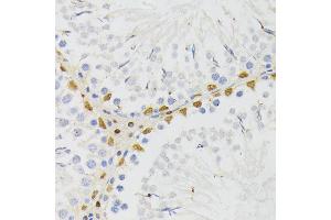Immunohistochemistry of paraffin-embedded rat testis using EL antibody (ABIN6132052, ABIN6140108, ABIN6140109 and ABIN6222942) at dilution of 1:200 (40x lens). (ELAC2 抗体  (AA 1-270))