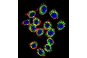 Immunofluorescence (IF) image for anti-RAS Guanyl Releasing Protein 2 (Calcium and DAG-Regulated) (RASGRP2) (AA 7-34), (N-Term) antibody (ABIN656117)