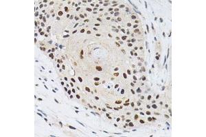 Immunohistochemistry (Paraffin-embedded Sections) (IHC (p)) image for anti-Karyopherin (Importin) alpha 4 (KPNA4) (AA 1-240) antibody (ABIN3015855)