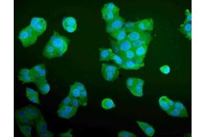 IF analysis of Aldolase/ALDOA using anti-Aldolase/ALDOA antibody (ABIN7601908). (ALDOA 抗体  (AA 50-364))
