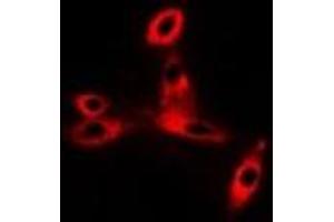 Immunofluorescent analysis of CD47 staining in Hela cells. (CD47 抗体)