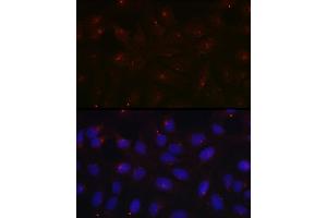 Immunofluorescence analysis of U2OS cells using PCM1 Rabbit pAb  at dilution of 1:100 (40x lens). (PCM1 抗体  (AA 1-260))