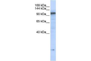 WB Suggested Anti-ATP2A2 Antibody Titration:  0. (ATP2A2 抗体  (C-Term))