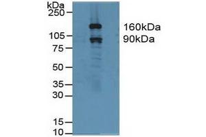 Detection of GSN in Human Hela Cells using Polyclonal Antibody to Gelsolin (GSN) (Gelsolin 抗体  (AA 577-771))