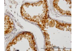 Immunoperoxidase of monoclonal antibody to CITED1 on formalin-fixed paraffin-embedded human testis.