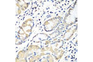 Immunohistochemistry of paraffin-embedded human stomach using EZR antibody. (Ezrin 抗体  (AA 350-470))