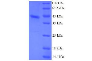 SDS-PAGE (SDS) image for Serum Amyloid A1 (SAA1) (AA 19-129) protein (His tag) (ABIN1461226)