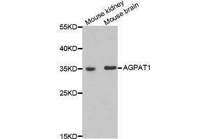 Western blot analysis of extracts of mouse kidney and mouse brain cell lines, using AGPAT1 antibody. (AGPAT1 抗体)