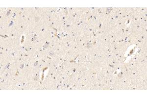 Detection of AHSG in Bovine Cerebrum Tissue using Polyclonal Antibody to Alpha-2-Heremans Schmid Glycoprotein (AHSG) (Fetuin A 抗体  (AA 19-359))