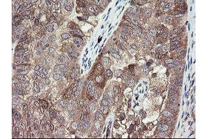 Image no. 11 for anti-TSC22 Domain Family, Member 1 (TSC22D1) antibody (ABIN1501535)