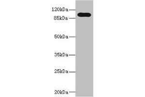 Western blot All lanes: TLR6 antibody at 5 μg/mL + Jurkat whole cell lysate Secondary Goat polyclonal to rabbit IgG at 1/10000 dilution Predicted band size: 92, 56 kDa Observed band size: 92 kDa (TLR6 抗体  (AA 32-586))