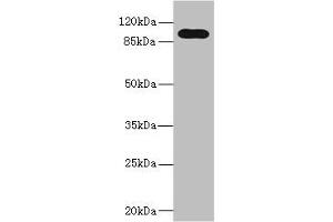Western blot All lanes: TLR6 antibody at 5 μg/mL + Jurkat whole cell lysate Secondary Goat polyclonal to rabbit IgG at 1/10000 dilution Predicted band size: 92, 56 kDa Observed band size: 92 kDa