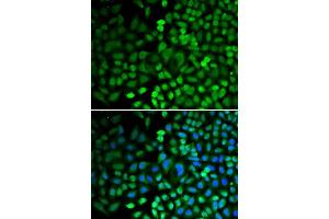 Immunofluorescence analysis of HeLa cells using APEX1 antibody. (APEX1 抗体  (AA 1-318))
