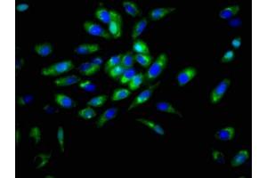 Immunofluorescence staining of Hela cells with ABIN7149787 at 1:166, counter-stained with DAPI. (Desmoglein 3 抗体  (AA 70-615))