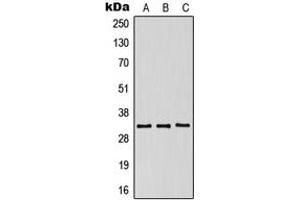 Western blot analysis of CD158g expression in HeLa (A), SP2/0 (B), NIH3T3 (C) whole cell lysates. (KIR2DS5 抗体  (Center))