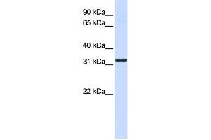 WB Suggested Anti-NANOS1 Antibody Titration:  0. (Nanos Homolog 1 抗体  (Middle Region))
