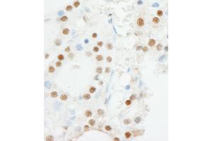 anti-Zinc Finger Protein 318 (Znf318) (AA 2049-2099) antibody