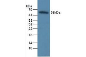 Detection of ICAM1 in Rat Liver Tissue using Polyclonal Antibody to Intercellular Adhesion Molecule 1 (ICAM1) (ICAM1 抗体  (AA 41-464))
