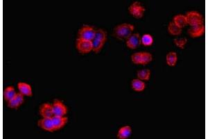Immunofluorescence (IF) image for anti-Regulator of Chromosome Condensation (RCC1) and BTB (POZ) Domain Containing Protein 2 (RCBTB2) (AA 1-200) antibody (ABIN7167421)
