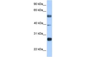 Western Blotting (WB) image for anti-MAX Dimerization Protein 3 (MXD3) antibody (ABIN2461943) (MXD3 抗体)