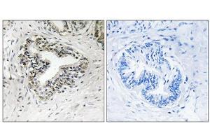 Immunohistochemistry analysis of paraffin-embedded human prostate carcinoma tissue using RPL30 antibody. (RPL30 抗体  (C-Term))