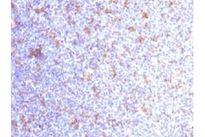 Immunohistochemistry (IHC) image for anti-Integrin, alpha X (Complement Component 3 Receptor 4 Subunit) (ITGAX) (AA 637-827) antibody (ABIN4949495)