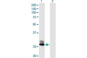 Western Blot analysis of CFHR2 expression in transfected 293T cell line by CFHR2 MaxPab polyclonal antibody. (CFHR2 抗体  (AA 1-270))