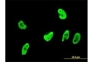 Immunofluorescence of monoclonal antibody to OXSR1 on HeLa cell. (OXSR1 抗体  (AA 351-450))