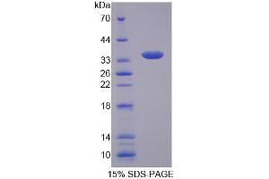 SDS-PAGE analysis of Human CTP Protein. (Slc25a1 蛋白)