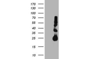 Western Blotting (WB) image for anti-Metalloproteinase Inhibitor 2 (TIMP2) antibody (ABIN1501394) (TIMP2 抗体)