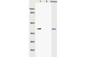 SDS-PAGE (SDS) image for anti-Zinc Finger, DHHC-Type Containing 9 (ZDHHC9) (AA 118-155) antibody (ABIN715676)
